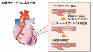 pf02_fig08